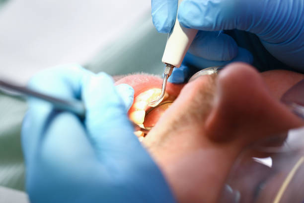 Best Orthodontic Emergency Dentist in Fuquay Varina, NC