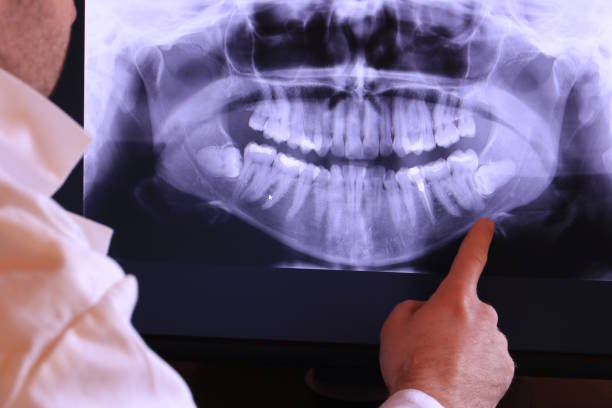 Best Emergency Dental Services for Seniors in Fuquay Varina, NC