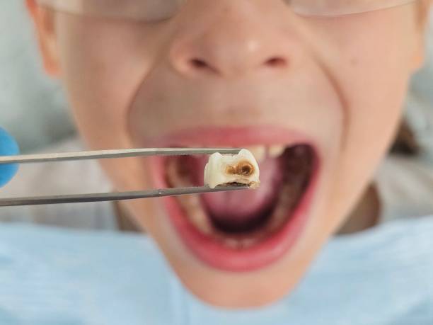 Best Emergency Cosmetic Dentistry in Fuquay Varina, NC